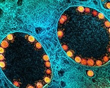 Coronavirus
