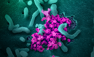 Microscopic view of Novel Coronavirus SARS-CoV-2