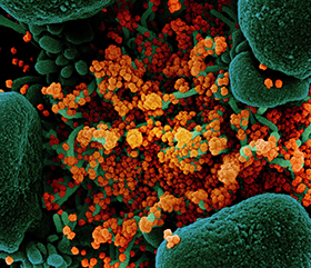 Microscopic view of Novel Coronavirus SARS-CoV-2