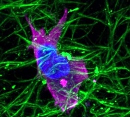 Microscopic view of fibroblasts