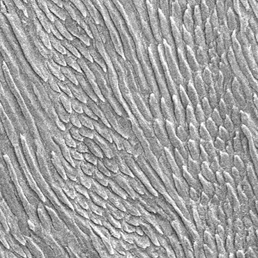 SEM of Human Enamel