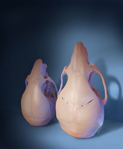 A stem cell-based treatment given to young mice with craniosynostosis regenerated the flexible joints between skull bones and restored skull shape and size (right), compared to untreated animals (left), as shown in this 3D rendering. 