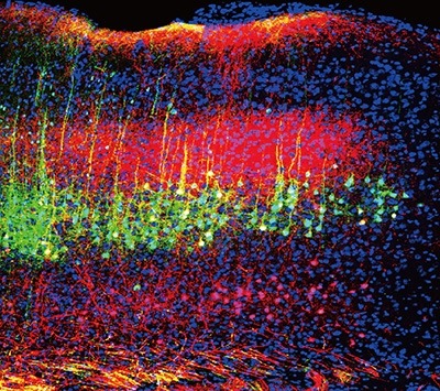Sound reduces pain in mice by lowering the activity of neurons in the brain’s auditory cortex (green and magenta) that project to the thalamus. 