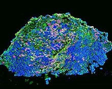 Robotic Massage Helps Regenerate Muscles in Mice 