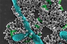 Scientists aim to transform tooth cleaning with magnetically controlled nanoparticle robots that can brush, floss, and sweep away dental plaque.