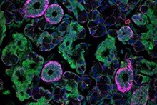 Microscopic view of norovirus.