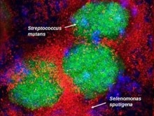 In an NIDCR-supported study, researchers identified a bacterial duo — Selenomonas sputigena (S. sputigena) and Streptococcus mutans (S. mutans) — linked to tooth decay in children.