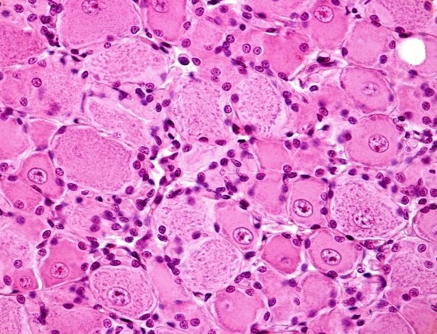 Image of nerve cell bodies in the dorsal root ganglia