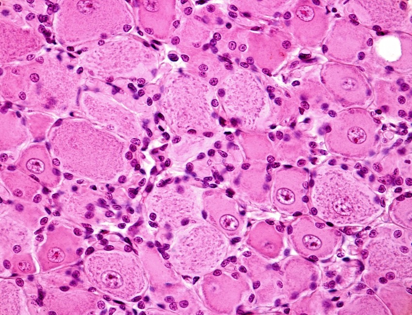 Image of nerve cell bodies in the dorsal root ganglia.