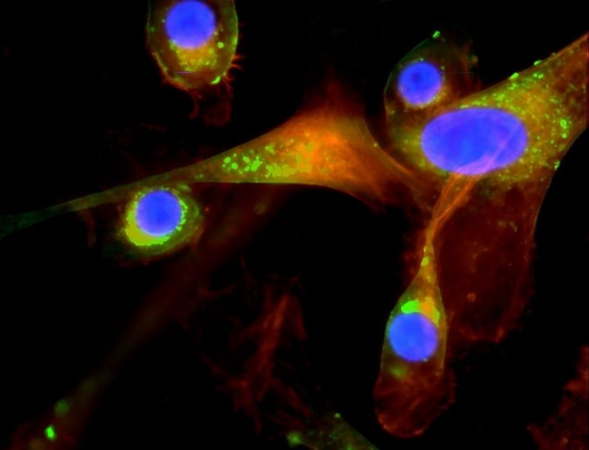 A microscopic view of an oral pathogen