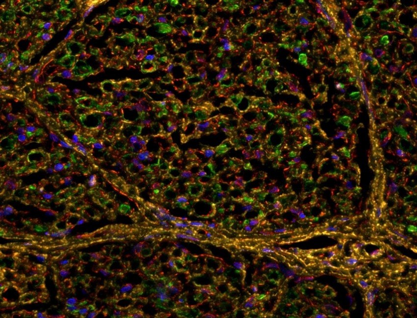 Sprinkled like confetti throughout this image are dozens of green-, yellow-, and red-ringed axons—nerve fibers that transmit electrical signals throughout the nervous system