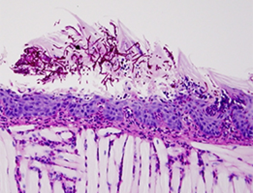 Mouse candida infection