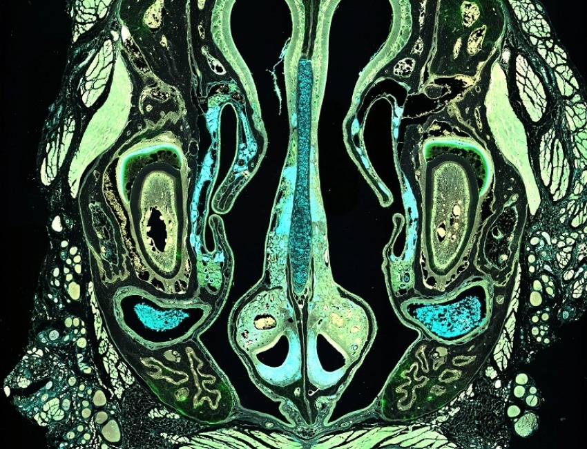 An x-ray image of the brain