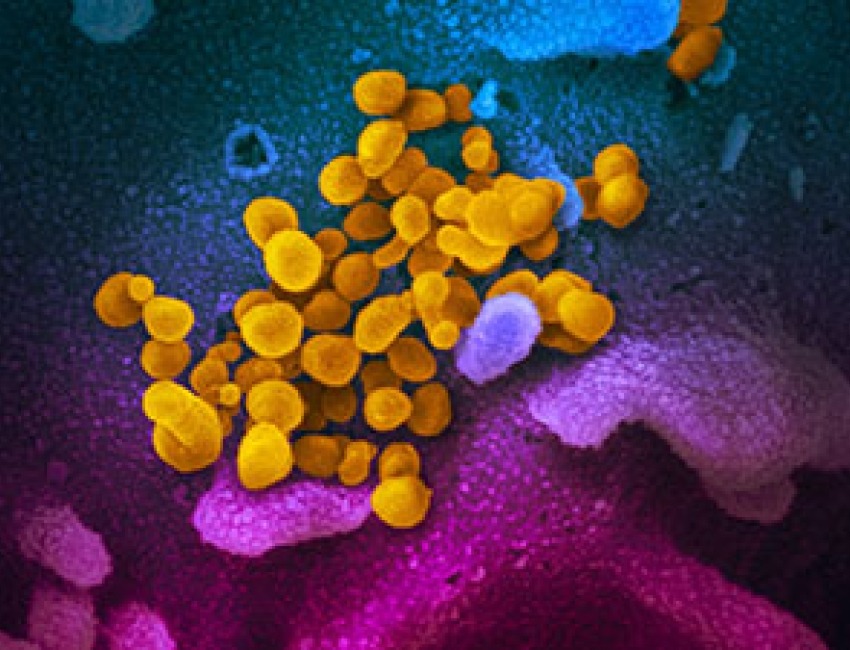 Imagen del coronavirus que causa COVID-19
