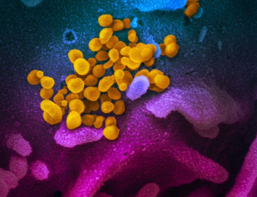 artistic rendering of coronavirus
