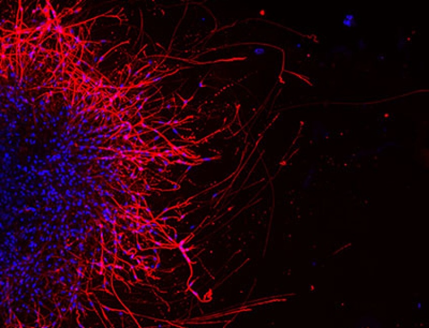 Image of oral cancer cells sending growth signals to nearby mouse sensory neurons via sprout projections called neurites.