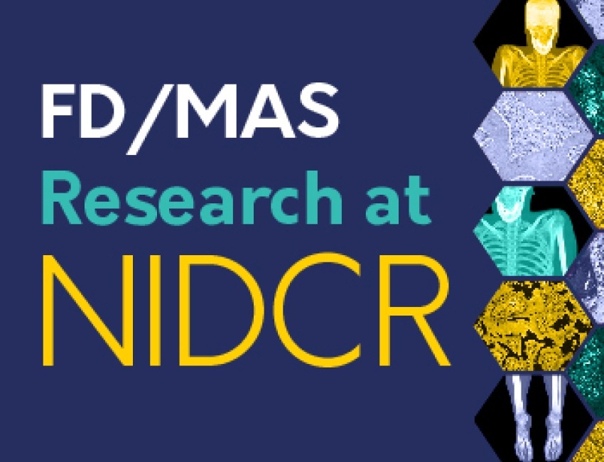 FD/MAS Research at NIDCR