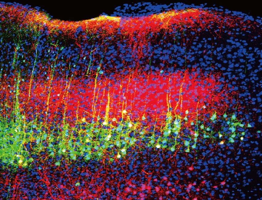 Newly identified brain circuits may point to better therapies to help reduce pain.