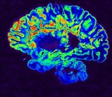 digital image of brain