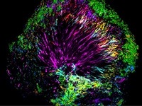 A microbiome community from human dental plaque.