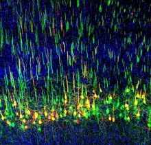 In mice, corticospinal neurons mainly govern voluntary movements. But Liu discovered that a subset of the neurons (above) amplifies touch signals and plays a role in mechanical allodynia, where gentle touch is perceived as pain.