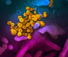 artistic rendering of coronavirus