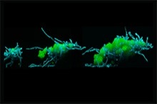Caught on camera: bacterial-fungal clusters “walking” on tooth-like surfaces to rapidly form dental plaque and promote decay. 