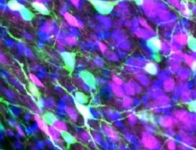 Newly discovered neural pain circuits in mice send signals directly to a key emotion-related node in the brainstem