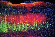 Mice neural mechanisms reacting to sound.