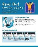 Seal Out Tooth Decay