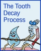 Illustration of a saliva droplet and fluoride toothpaste on the same team pulling on a rope in a game of tug-of-war against bacteria and sugars that can eat away at tooth enamel. 