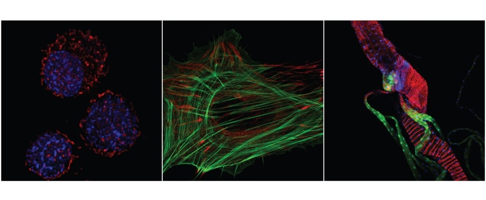 Confocal Based Imaging.