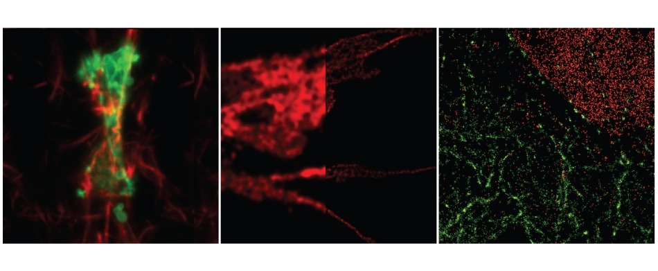 Super Resolution Imaging