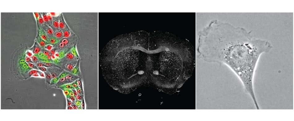 Automated Widefield Imaging.