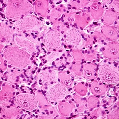 Image of nerve cells in the dorsal root ganglia