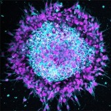 Yamada cancer cell spheroid