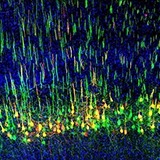 In mice, corticospinal neurons mainly govern voluntary movements. But Liu discovered that a subset of the neurons (above) amplifies touch signals and plays a role in mechanical allodynia, where gentle touch is perceived as pain. | Yuanyuan Liu