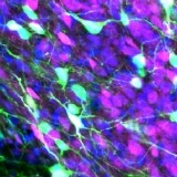PBN labeled pain neurons