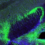 Scientists found a group of neurons that blunt pain by sending out projections (green) that suppress activity in multiple pain-processing centers in the mouse brain. 