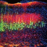 Sound reduces pain in mice by lowering the activity of neurons in the brain’s auditory cortex (green and magenta) that project to the thalamus. 