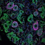 A microscopic view of salivary gland acinar epithelial cells (pink) infected with rotavirus (green), a type of enteric virus, in a mouse. 
