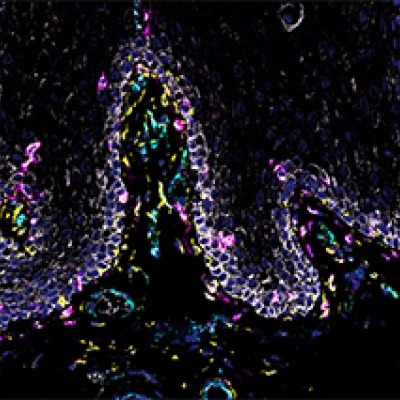 Oral Mucosa Cells
