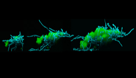 Candida albicans fungi (blue) and cavity-causing Streptococcus mutans bacteria (green) form assemblages that “walk” and “lunge” across tooth-like surfaces.
